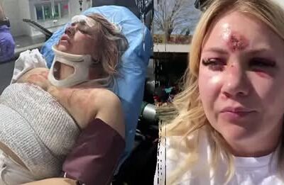 😱🔥 Bride-to-Be Left with Broken Nose and Teeth in Brutal Attack! Horrific Bachelorette Nightmare in Dallas: Bride’s Celebration Turns to Terror—What Happened Before the Assault?👇👇FULLSTORYHERE👇👇
