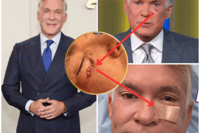 “I’m Not Okay, But Don’t Worry”—Sam Champion Breaks Silence on Skin Cancer Battle
