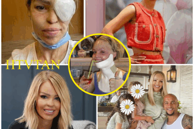 “TEN YEARS LATER—SHE’S NOT THE SAME WOMAN (AND NEITHER IS HE).” Katie Piper’s shocking 10-year transformation and the strange shift inside her marriage—scarred for life after an acid attack, she now says it’s “hard but worth it.” 🔥  No glossy fairytale. No easy edit. Just a decade of grit that rewired two people from the inside out—love, fear, setbacks, and a comeback that feels like a full-on metamorphosis.  What changed in year ten that flipped their dynamic? How did a private role-reversal become the engine of their resilience? And what moment forced them to rebuild—piece by piece—into something new?  Tap to see the before-and-after everyone’s talking about, the vows they quietly rewrote, and the one lesson that makes this “impossible” love story impossible to ignore.