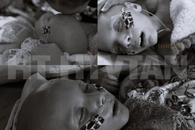 CH2 . Many have asked if Bryson has passed. Right now, he’s still with us.  He’s in the final phase, fragile, weak, yet still fighting. Every breath is a victory, every heartbeat a miracle. His small body struggles, but his spirit burns with courage that humbles everyone around him.  We stay by his side constantly—holding his hand, whispering love, offering comfort and presence. The tubes, the medications, the disease itself—they can’t touch the strength of his spirit or the love that surrounds him.  This is a time of profound grief and unwavering hope. Each small smile, each gentle response, reminds us that even in suffering, there is connection, there is joy, there is love.  Bryson teaches us about courage, patience, and the boundless capacity of a parent’s heart. We are here, honoring him, cherishing every moment, and holding onto hope as long as he is still with us. Full story in the comment👇